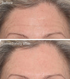 Murad Targeted Wrinkle Corrector 15ml, imported from the UK