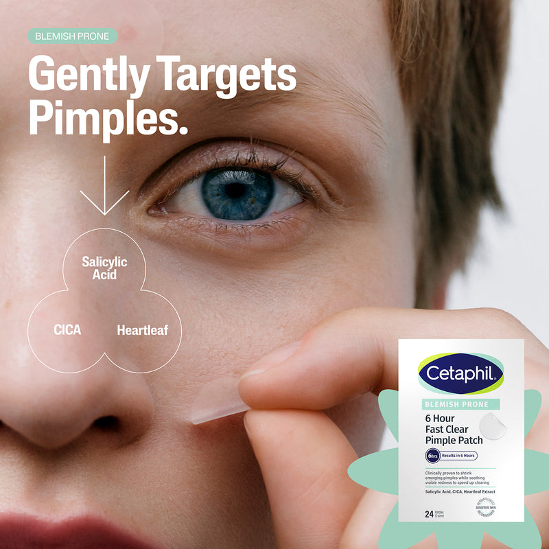 Cetaphil pimple patches with salicylic acid 24 pack - British product