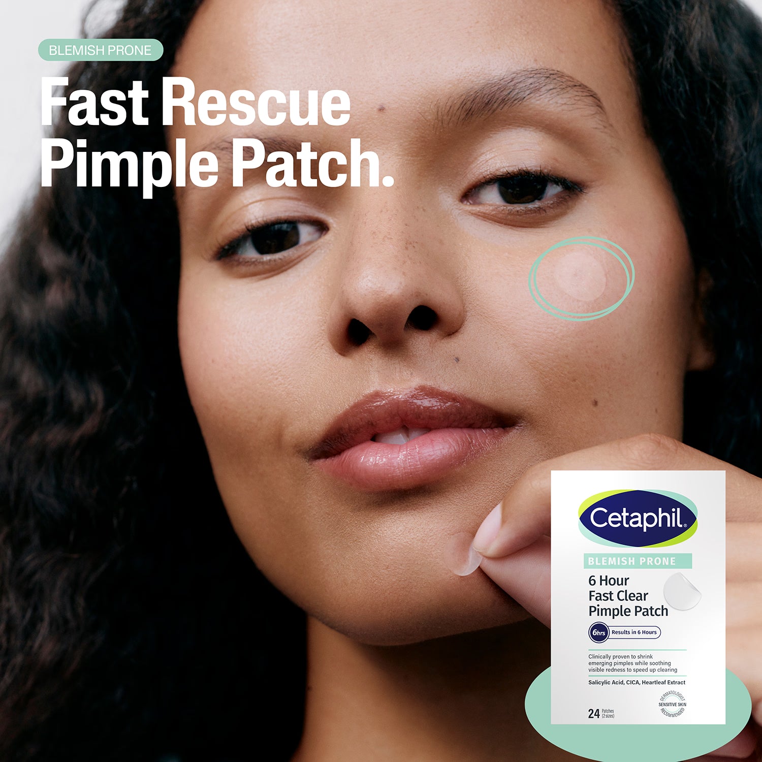 Cetaphil pimple patches with salicylic acid 24 pack - British product