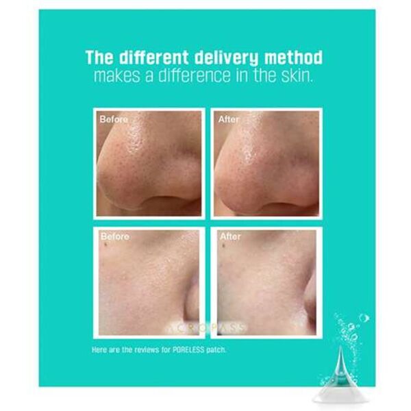 Acropass Poreless Microneedle Bubble Pack 6 pcs, UK version