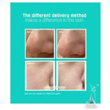 Acropass Poreless Microneedle Bubble Pack 6 pcs, UK version