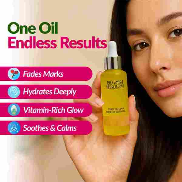 Rio Rosa Mosqueta Rosehip Seed Oil 20ml, UK version