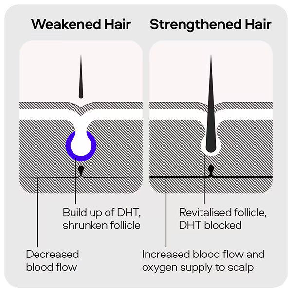 Sons Shampoo for Male Pattern Hair Loss 200ml (British brand)