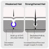 Sons Shampoo for Male Pattern Hair Loss 200ml (British brand)