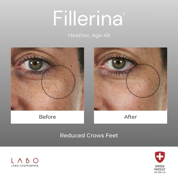 Fillerina eye cream Grade 3 15ml - British product