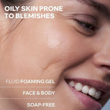 Uriage Anti-Blemish Cleansing Gel 150ml, UK version