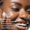 Cetaphil gentle clear blemish moisturiser 89ml (British brand)