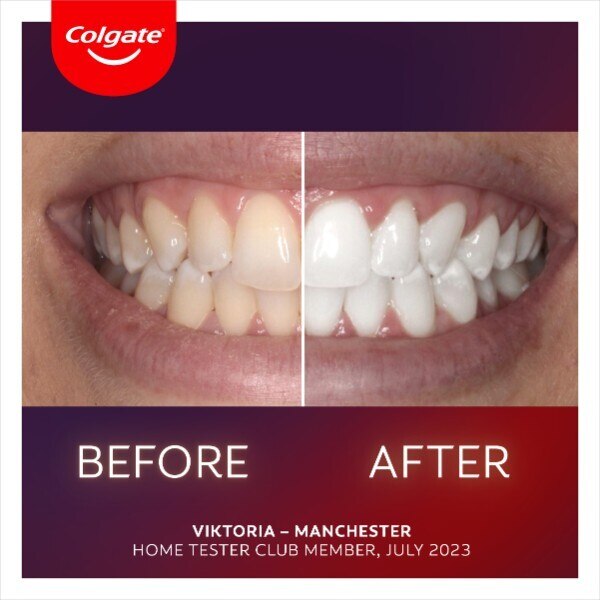 Colgate Max White LED Whitening Kit GOODS Superdrug   