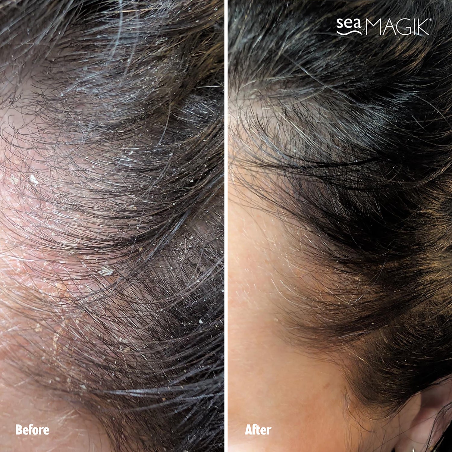 Natural Conditioning Scalp and Hair Mud Treatment