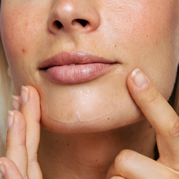 Vue Chin Patches 8 patches imported from the UK