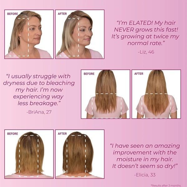BosleyMD Hair Loss Shampoo MendXtend 1 Litre - McGrocer