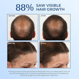 BosleyMD Hair Loss Shampoo Non Colour Treated  300ml - McGrocer