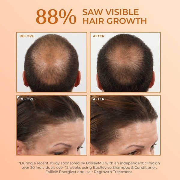 BosleyMD Hair Loss Shampoo Revive Colour Safe 1 Litre - McGrocer