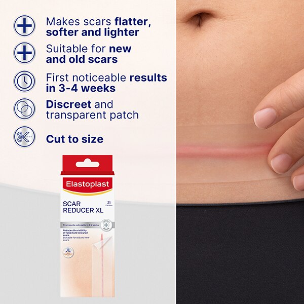 Elastoplast Scar Reducer Xl, 21 Plasters GOODS Superdrug   