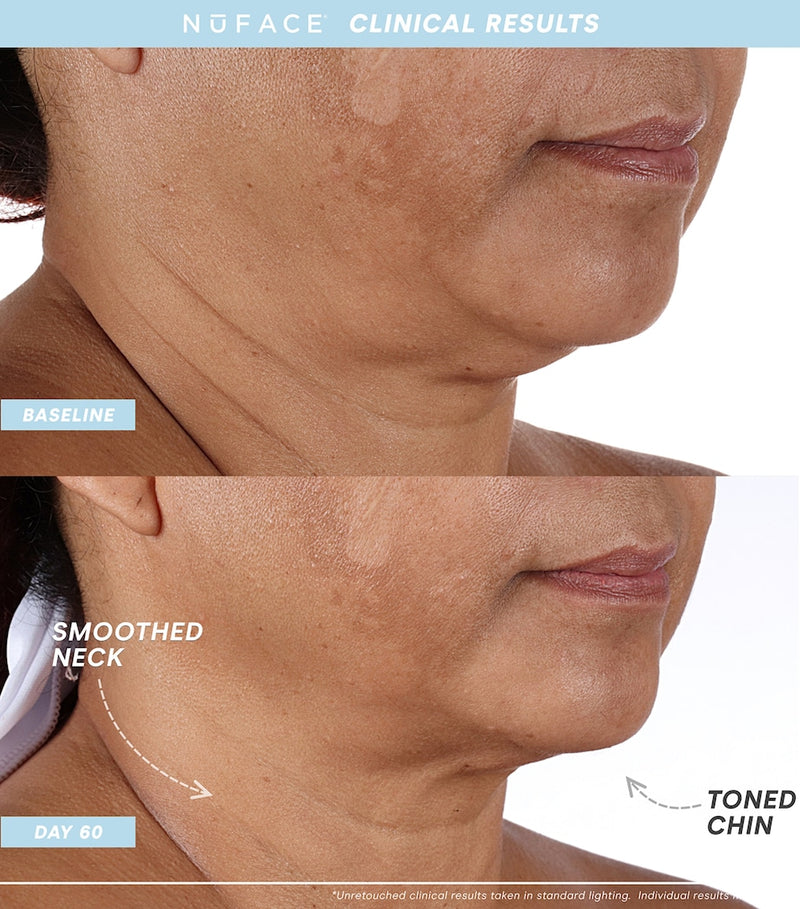 NuFACE Mini+ Facial Toning Device Starter Kit, imported from the UK