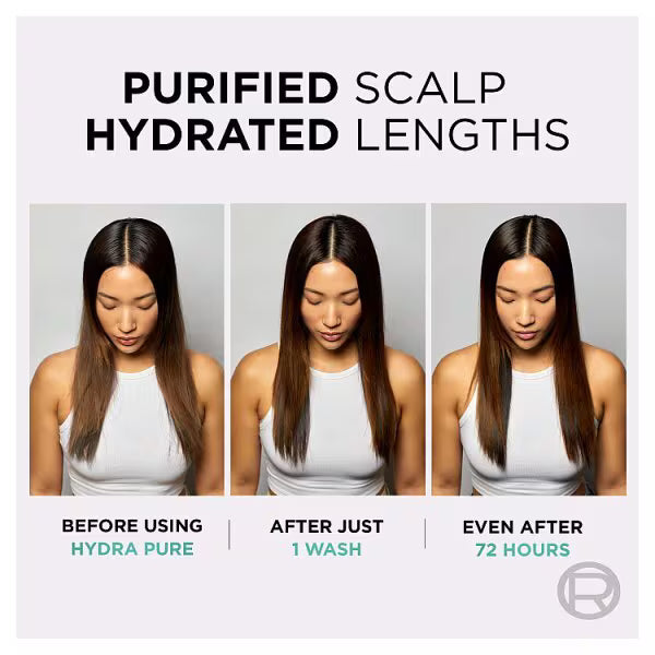 L'Oreal Paris Elvive Hydra Pure Scalp Serum, UK version
