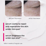 Veoli Botanica lifting-repairing undereye serum 15ml, imported from the UK