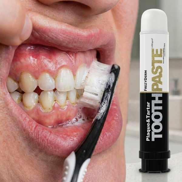 FrezyDerm Plaque & Tartar toothpaste 75ml (British brand)