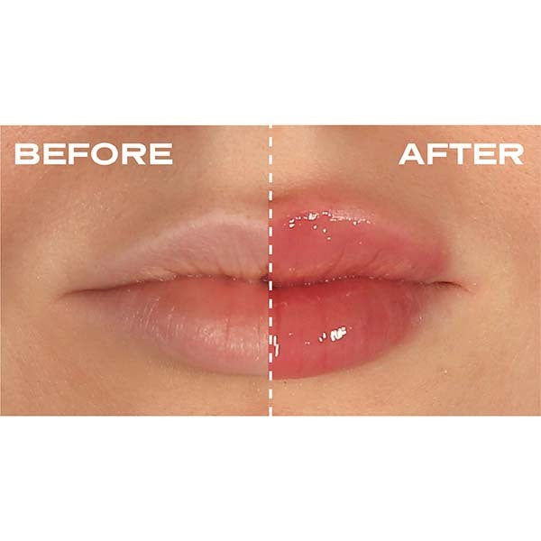 Plump It! No Needles Lip Filler Kit 2x 3ml - British product