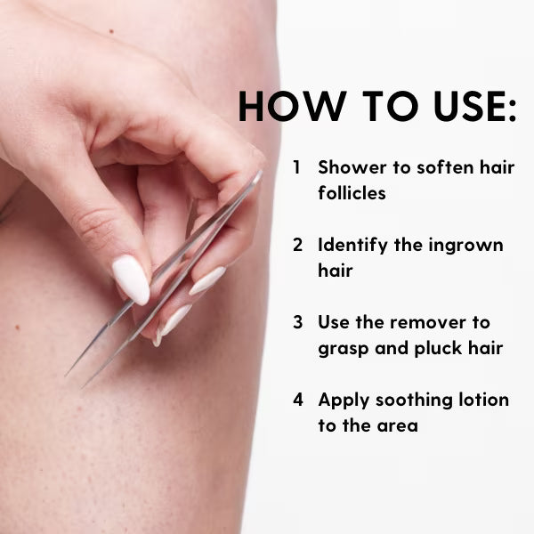Superdrug Ingrown Hair Remover Stainless Steel (British brand)