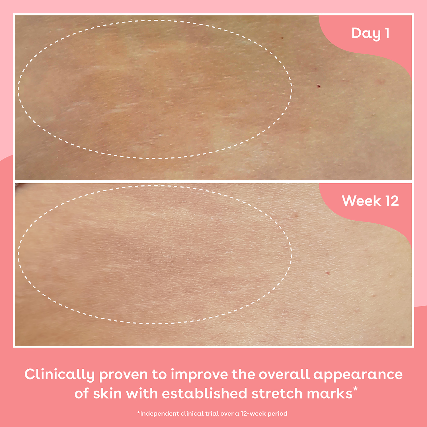Q+A Collagen Body Oil 150ml moisturising oil (British brand)
