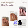Margaret Dabbs London Nail Fungus Laser Device - British product