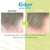 KinKind anti-dandruff conditioner bar 40g, imported from the UK