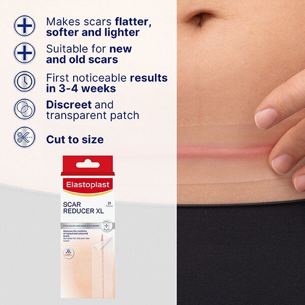 Elastoplast Scar Reducer Xl, 21 Plasters