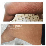 âme pure Body Basic | Stretch Marks 0.75mm GOODS Superdrug   