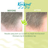 KinKind anti dandruff shampoo bar 50g - British product