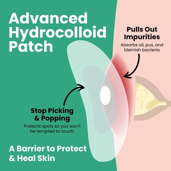 LLS hydrocolloid spot patches 60pk, imported from the UK