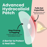 LLS hydrocolloid spot patches 60pk, imported from the UK