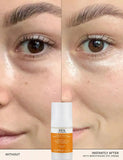 Κρέμα ματιών Radiance Brightening Dark Circle 15ml