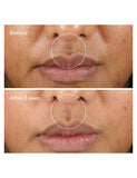 Rapid Relief Sulfur Mask 75ml