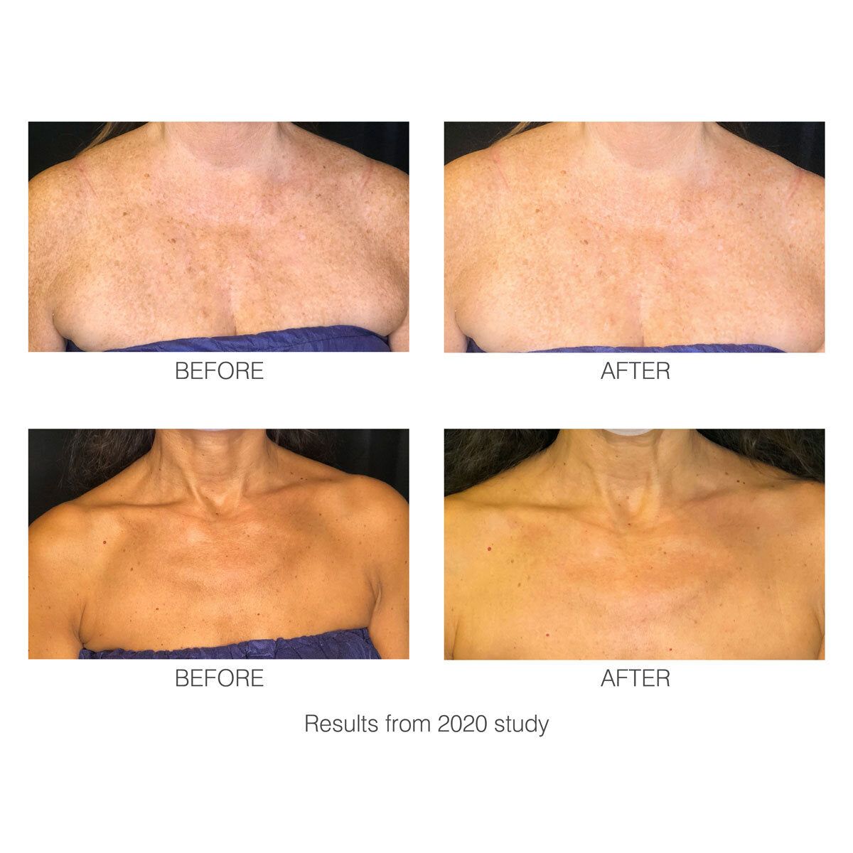 Rio decoLITE Beauty Boosting LED Treatment