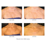 Rio decoLITE Beauty Boosting LED Treatment