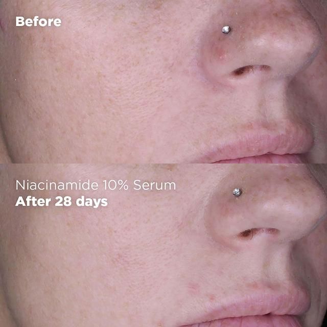 Skin Republic Niacinamide 10% + Zinc 1% Serum   30g