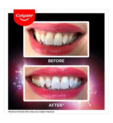 Colgate Max White Ultra Active Foam whitening toothpaste
